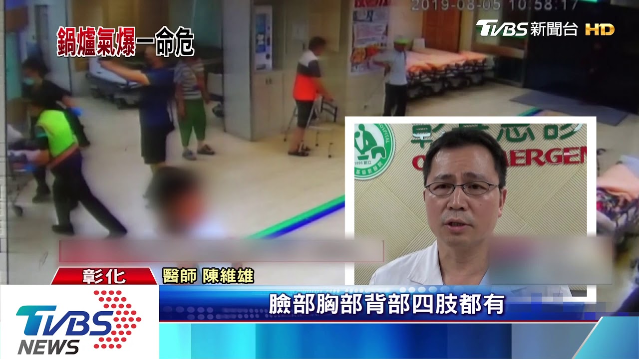 被火焰追著跑 傷者頭髮燒焦說驚險瞬間