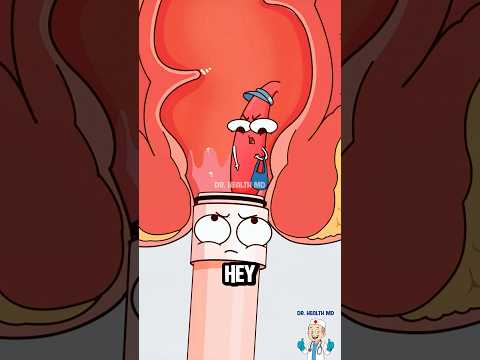 This Is How Doctors Treat Hemorrhoids! 🤯 #hemorrhoids #shorts