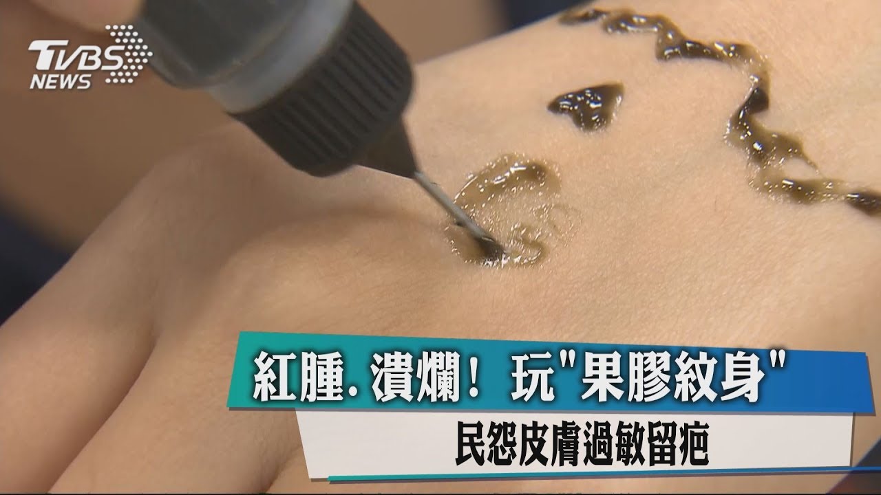 什麼!用果膠紋身竟變永久留疤 業者這樣答拳頭都硬了