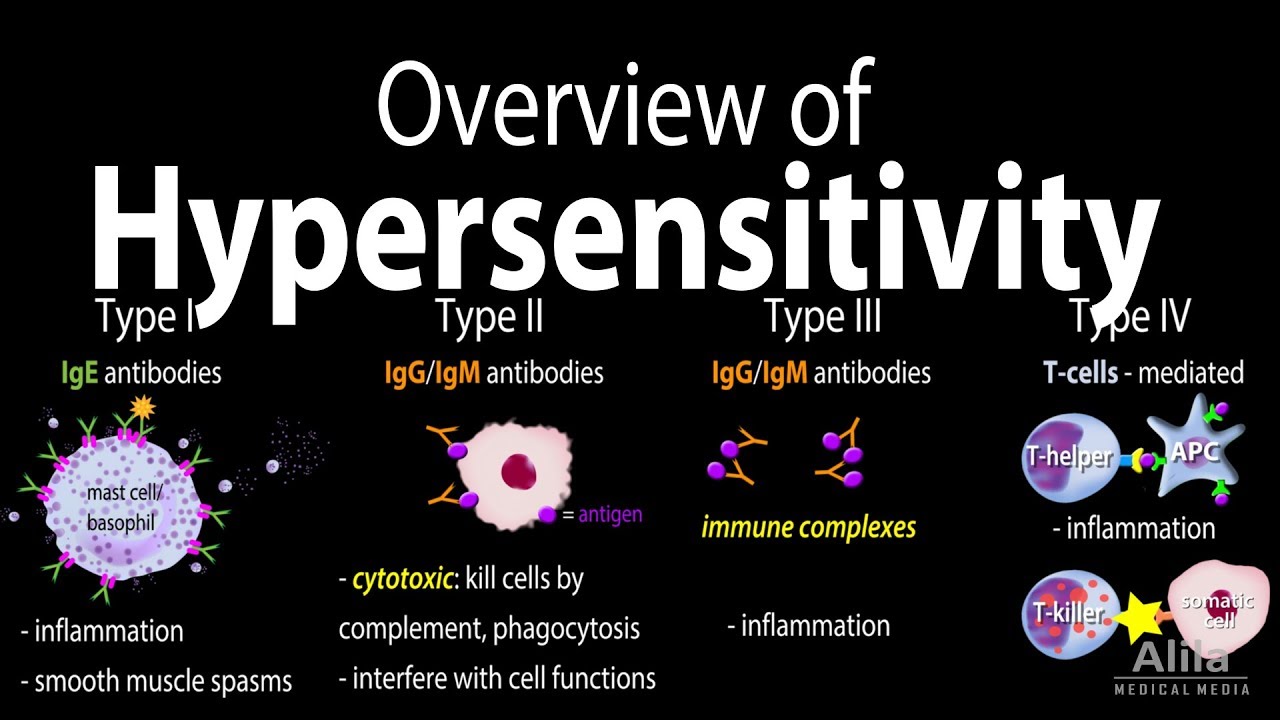 Hypersensitivity, Overview of the 4 Types, Animation.