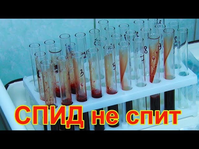 Видео: сколько чистопольцев имеют положительный  ВИЧ-статус