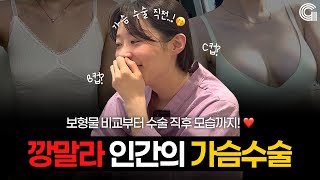 깡말라 인간의 수술 후기
