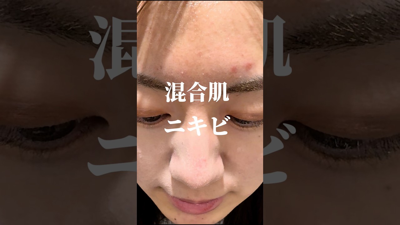 肌改善企画最終回‼️