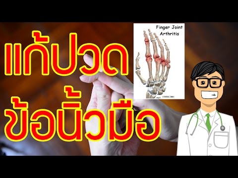 โรคสะเก็ดเงินบนมือและไหล่ของเขา ที่จะหยุดปฏิกิริยาแพ้กลากลมพิษ
