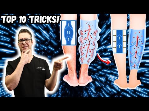 How to Lower Blood Pressure Causes Signs Symptoms What is it