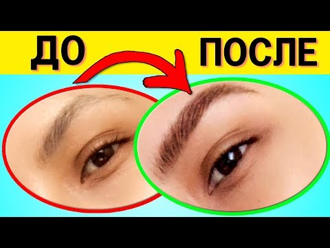 Как быстро отрастить Густые брови, натуральными 'лекарствами'