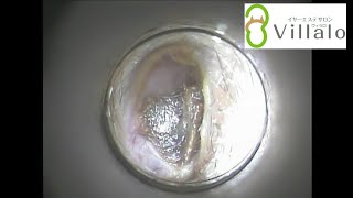 耳掃除動画vol.29「マッサージ動画から来ました」