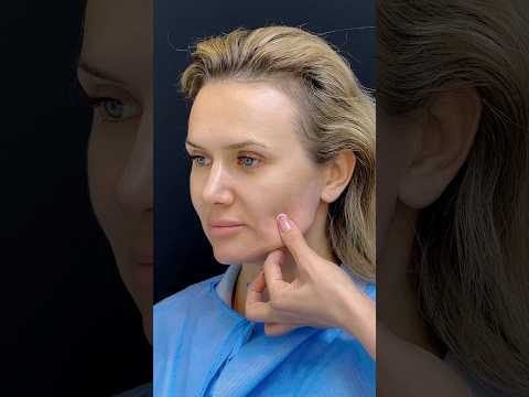 Combination Treatment
