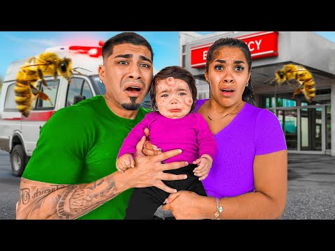 Our Baby Got Stung By a BEE! 