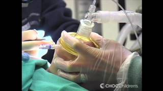 Lumps and Bumps in Children: Dr. Reyna, CHOC Children&#39;s