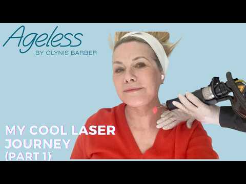 My Cool Laser journey (Part 1) — video featuring Lisa Harris