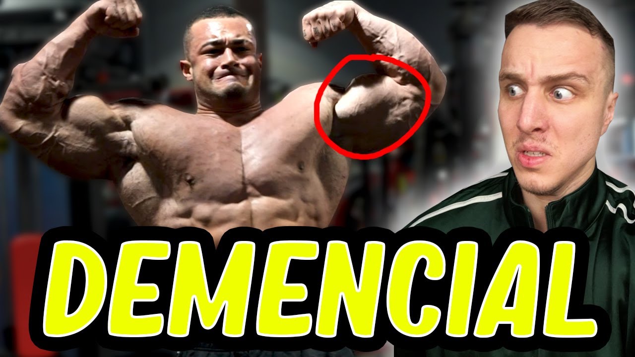 El trágico final de Genetic Anomaly está escrito *ha ganado 10 kg en 3 meses*