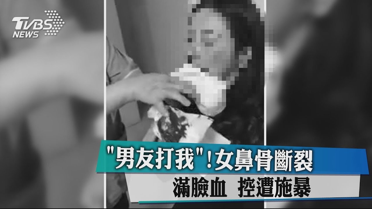 「男友打我」!女鼻骨斷裂滿臉血 控遭施暴