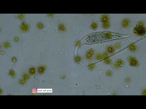 This is an incredible microorganism Lacrymaria olor.   Lacrymaria olor means "swan tear" in Latin.