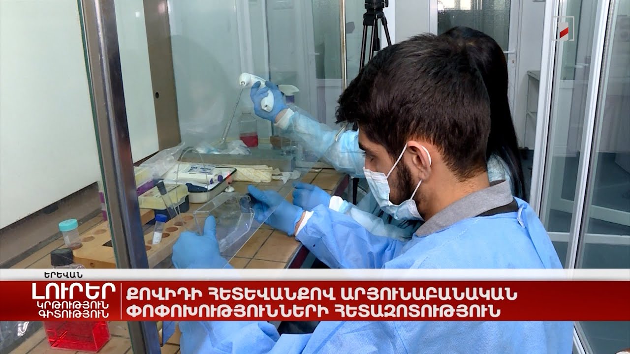 Քովիդի հետևանքով արյունաբանական փոփոխությունների հետազոտություն