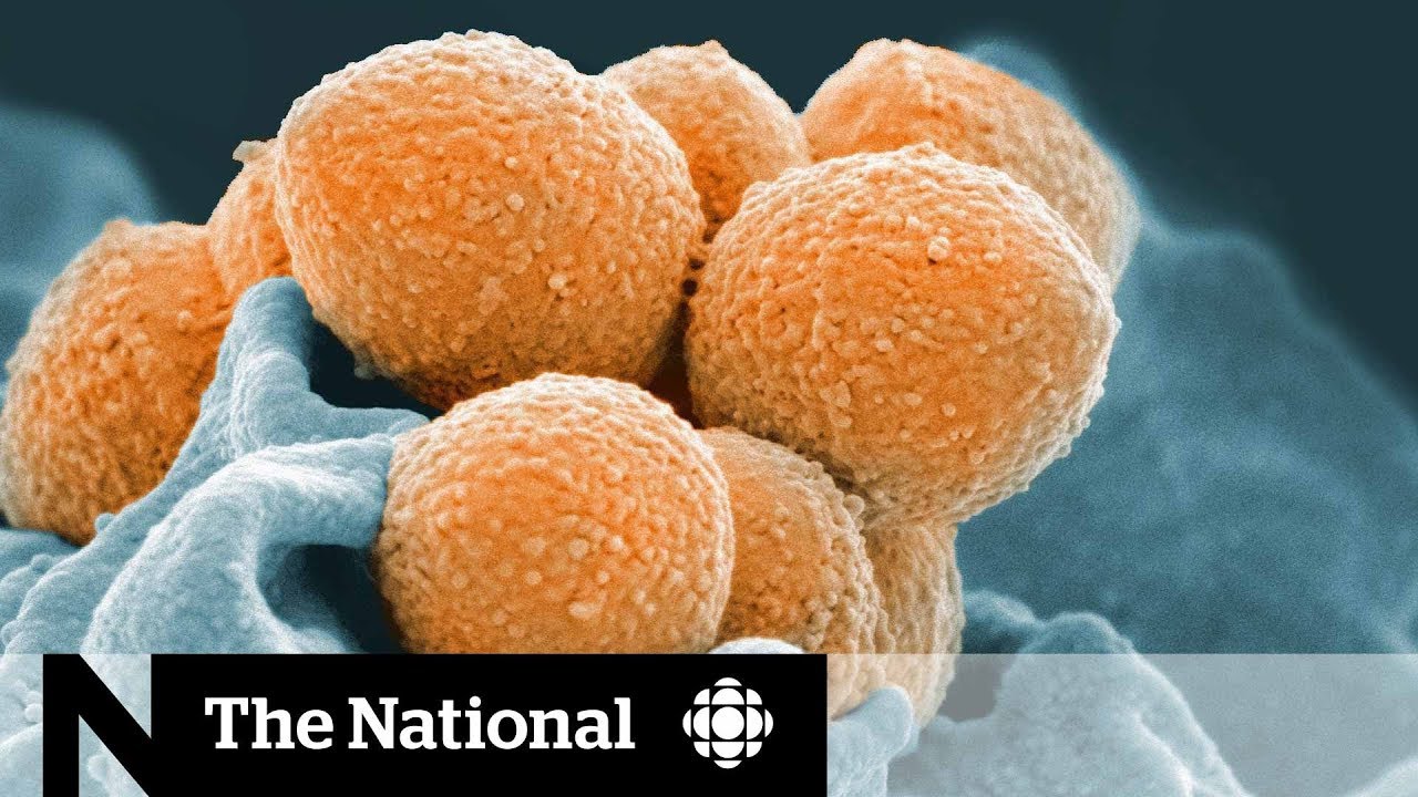 The Invisible Siege: Investigating the Rise of Rare, Invasive Bacterial Infections in Canada