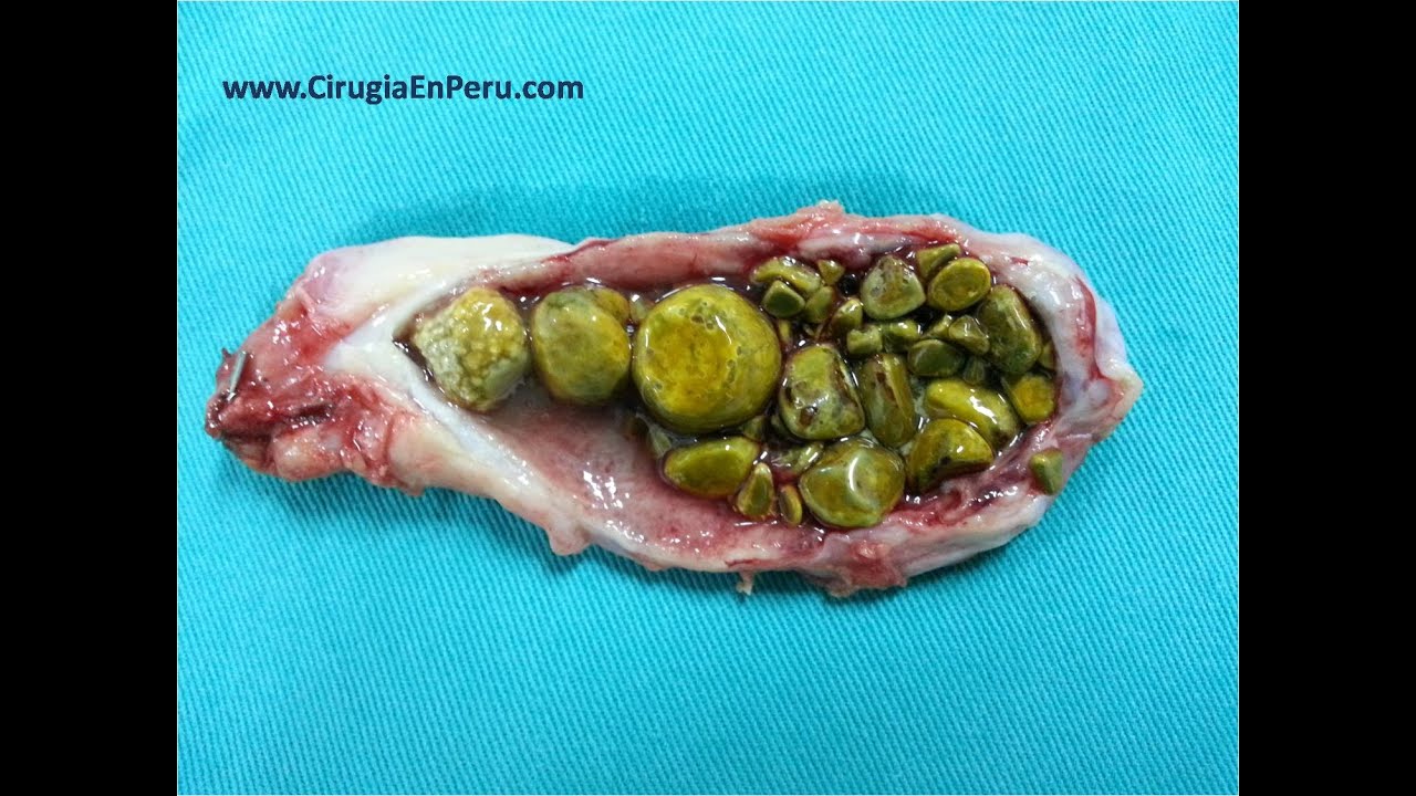 Alberto Gómez Meléndez-19