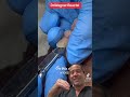SHAVING A WICKED TOE CORN Shorts