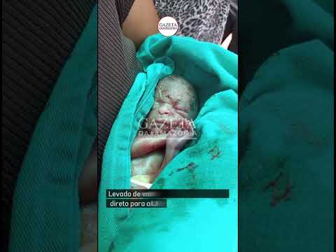 Bebê vivo dado como morto chora no momento do velório  #gazetadaamazonia