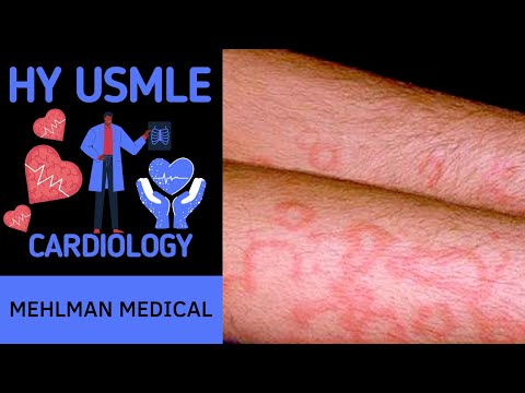 Unmögliches Murmeln Q - So erreichen Sie 280 Punkte bei USMLE Schritt 1