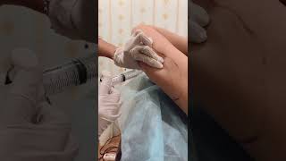 Download lagu Suntik lengan buat lengan kecil checkkkkk #viralvideo #konsultasigratis #treatment #suntiklengan mp3