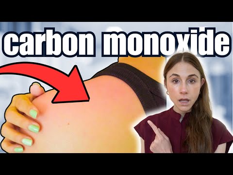 Warning Signs Of Carbon Monoxide Poisoning NOT TO MISS