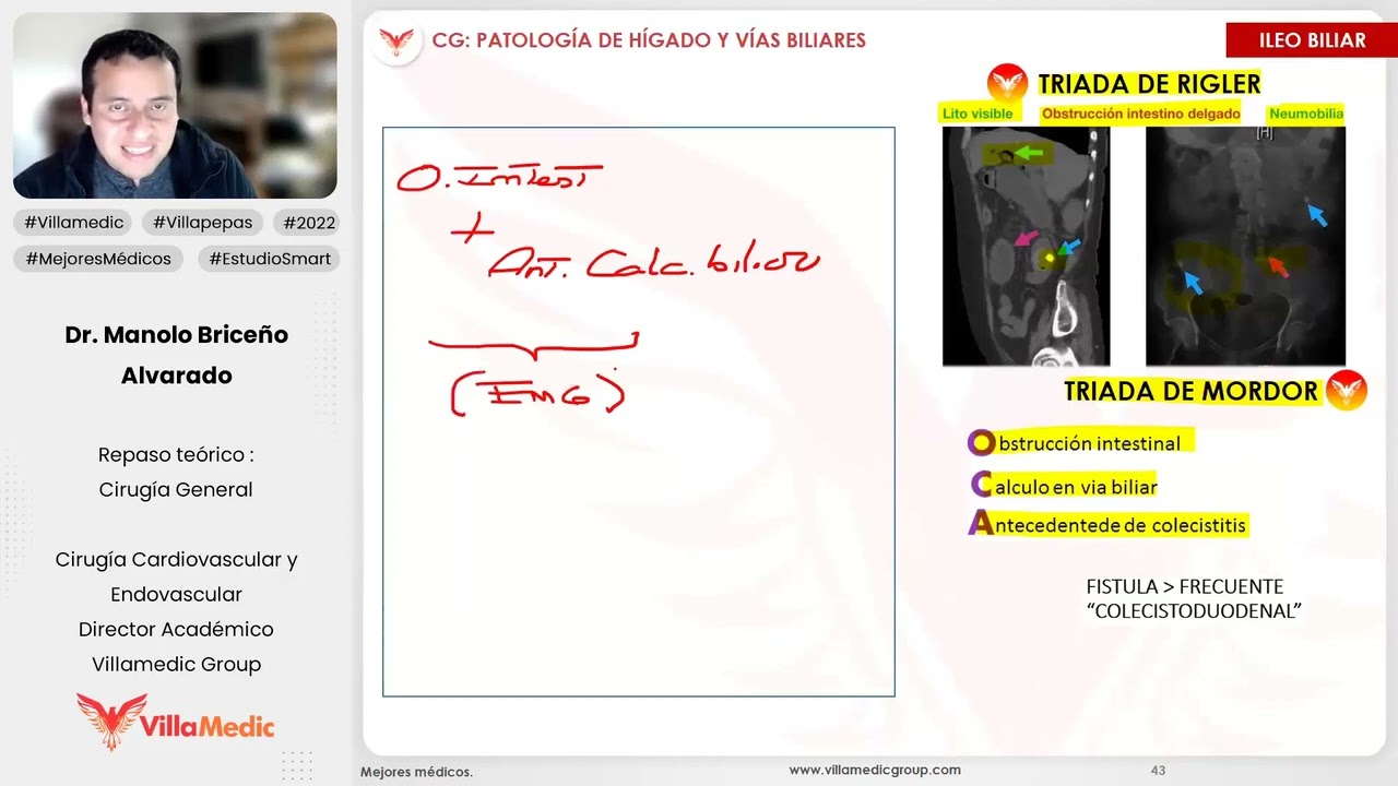 PATOLOGÍA DE HÍGADO Y VÍAS BILIARES PARTE 3 - CIRUGÍA GENERAL - VILLAMEDIC