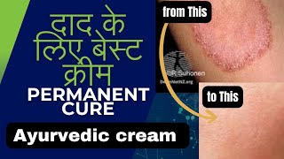 Best ayurvedic cream for fungal infection MONk 2 SKINo | Daad ki best medicine cream | दाद की क्रीम