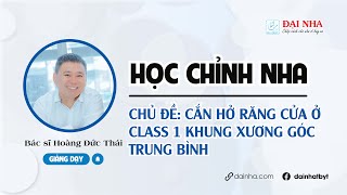 [Học chỉnh nha] - CẮN HỞ RĂNG CỬA Ở CLASS 1 KHUNG XƯƠNG GÓC TRUNG BÌNH. Bs Hoàng Đức Thái.
