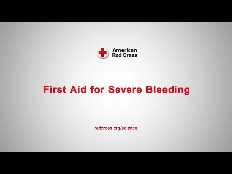First Aid for Severe Bleeding
