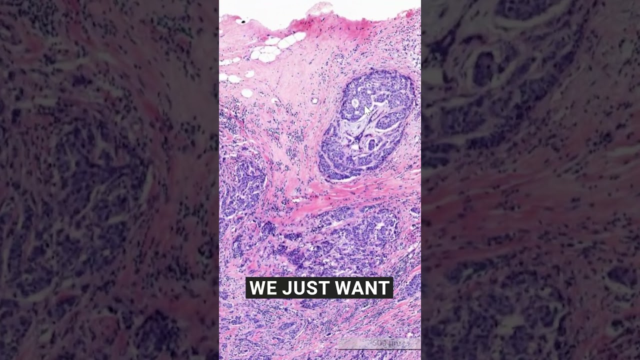 Just annotate it well and your tissue image analysis model will perform