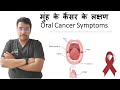 Dr Rudra Mohan Oral Cancer Symptoms Symptoms Of Oral Cancer Be Careful Of These Signs