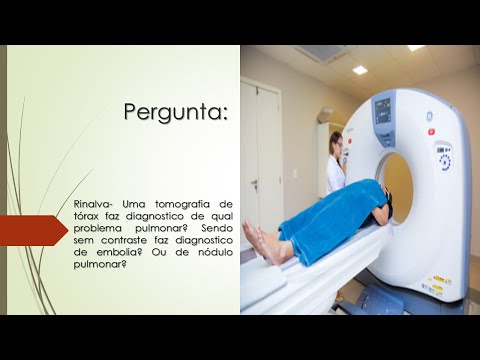 Tomografia de tórax faz diagnostico de qual problema pulmonar? | Faz diagnostico de embolia?