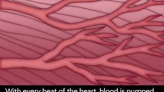 Angiogensis After Injury