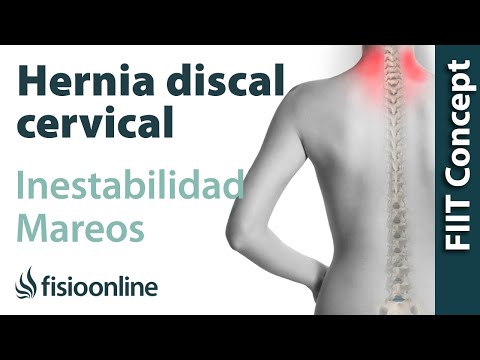 ¿Puede una hernia discal cervical provocar mareos e inestabilidad?