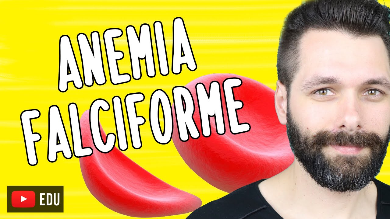 ANEMIA FALCIFORME | Biologia com Samuel Cunha
