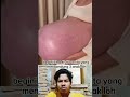 Begini Perut Gantung Ibu Hamil Yang Mengerikan Shorts Reaction Ibuhamil Dokter