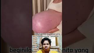 Download lagu begini perut gantung ibu hamil yang mengerikan #shorts #reaction #ibuhamil #dokter mp3 Download lagu begini perut gantung ibu hamil yang mengerikan #shorts #reaction #ibuhamil #dokter mp3