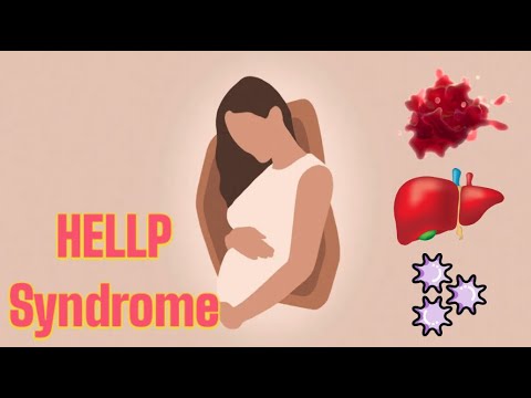 HELLP Syndrome (updated 2023) - CRASH! Medical Review Series