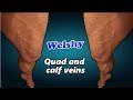 Lean bodybuilder exposing all those huge quad and calf veins