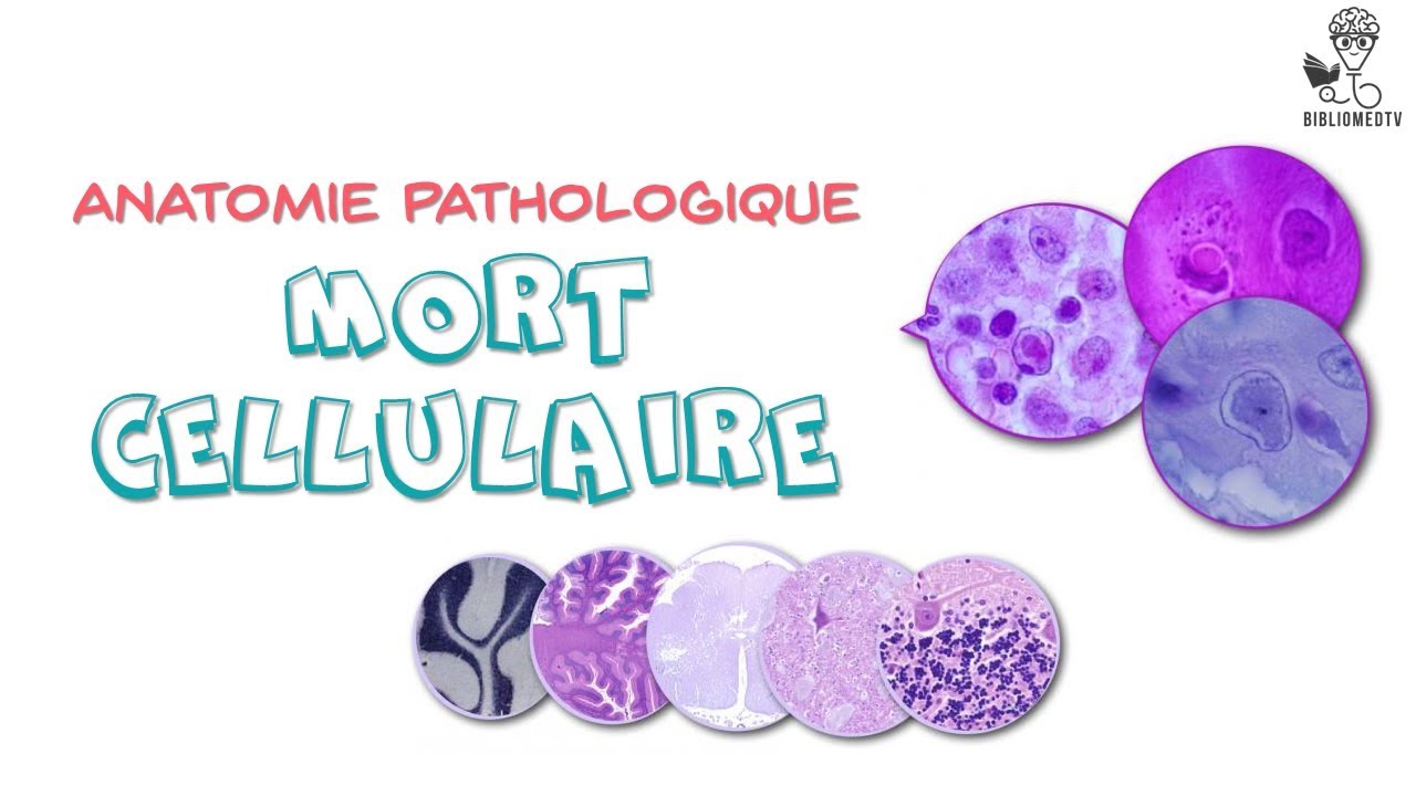 Anatomie Pathologique - la Mort Cellulaire