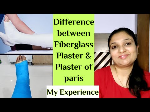 फाइबरग्लास प्लास्टर और प्लास्टर ऑफ पेरिस के बीच अंतर || मेरा अनुभव @dollyparmar6462