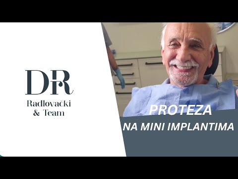 Odgovori na najčešća pitanja vezana za Proteze na Mini implante