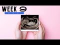 Baby | 9 weeks ultrasound scan ✅ 🚼 Fetal development #pregnancy