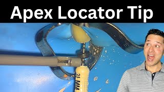 "My Apex Locator Isn't Working"....Try this...