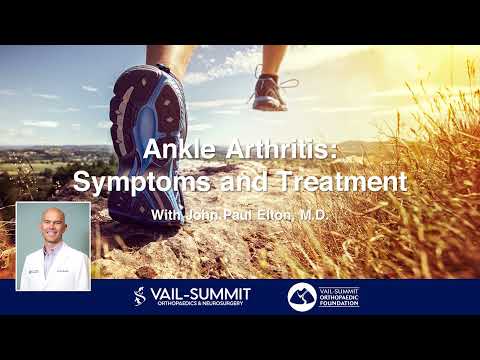 Ankle Arthritis: Symptoms and Treatments