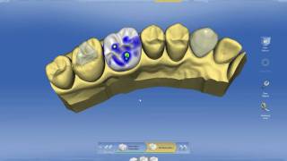 CEREC 4.0: Introduction - Raúl Pascual Campanario