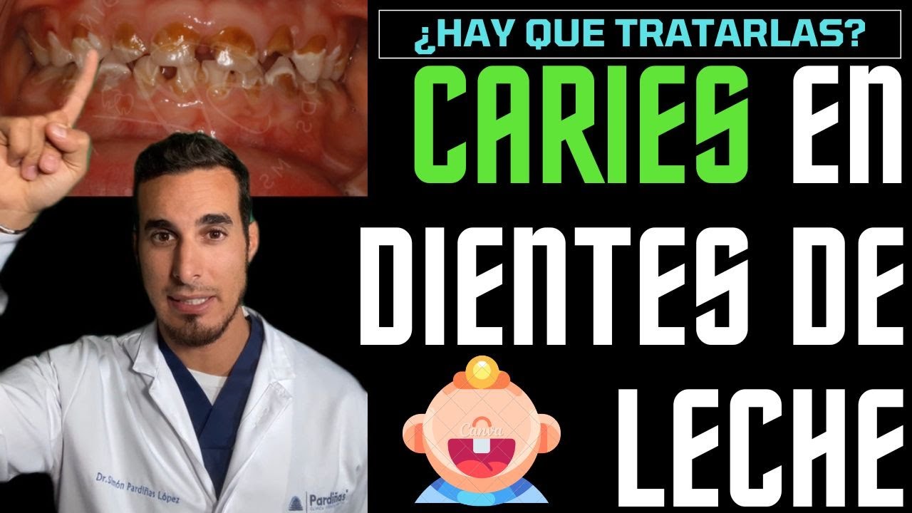 Watch Las CARIES en niños con DIENTES DE LECHE no hace falta tratarlas. 🤥¡MENTIRA! Now Las CARIES en niños con DIENTES DE LECHE no hace falta tratarlas. 🤥¡MENTIRA!