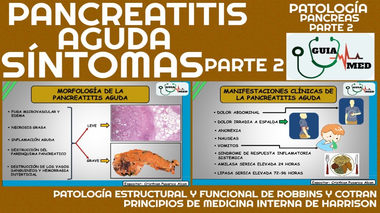 PANCREATITIS AGUDA SIGNOS Y SÍNTOMAS | GuiaMed