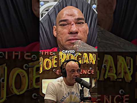 MVP Meets Cyborg After BREAKING His Skull🥊☠️